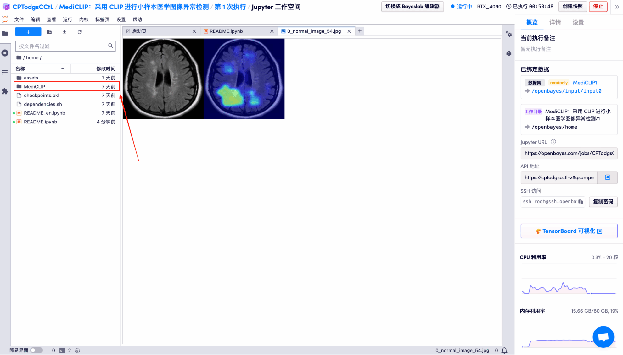 在线教程丨仅需极少量医学影像数据，MediCLIP 在异常检测与定位任务中刷新 SOTA-AI.x社区
