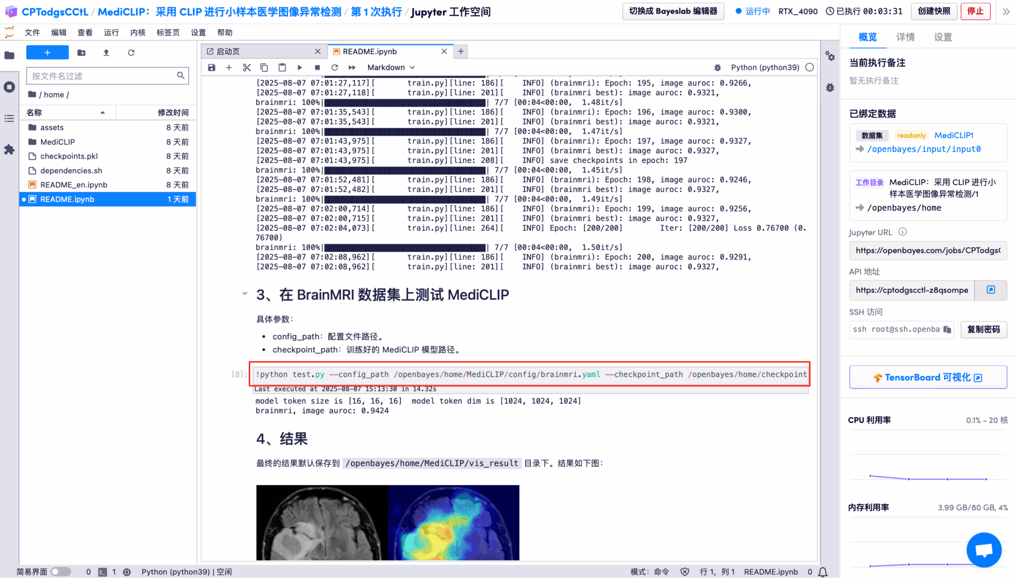 在线教程丨仅需极少量医学影像数据，MediCLIP 在异常检测与定位任务中刷新 SOTA-AI.x社区